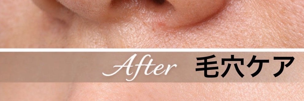 (あきる野) facial エステsalon bloom『訪問エステ』の画像